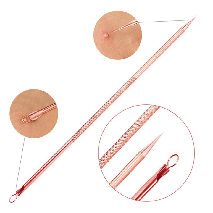 Blackhead &amp; Pimple Extractor Kit