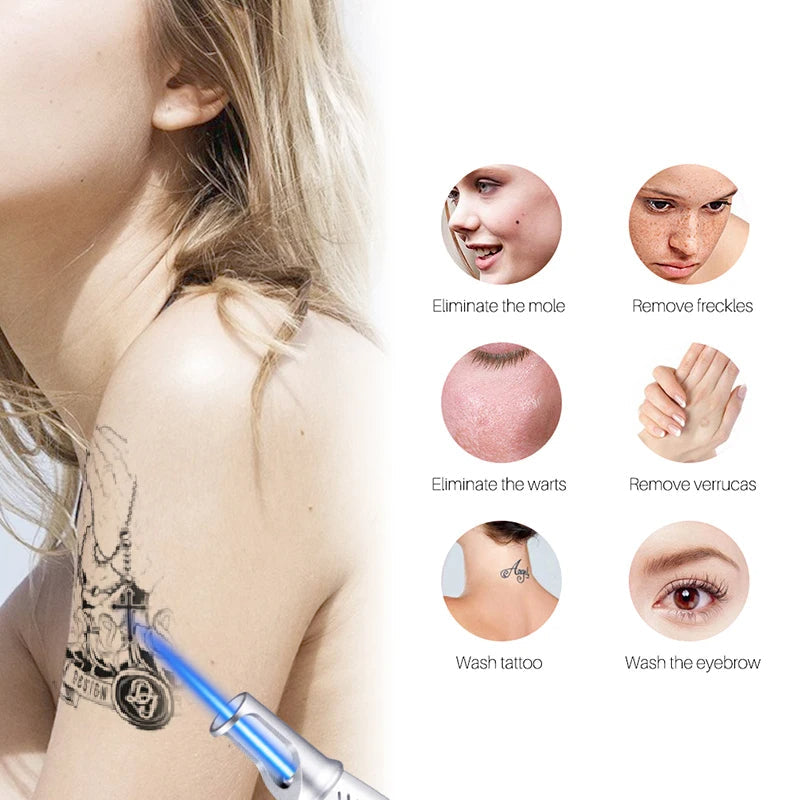 LumiDerm Laser Pen for Tattoo, Moles &amp; Freckles Removal