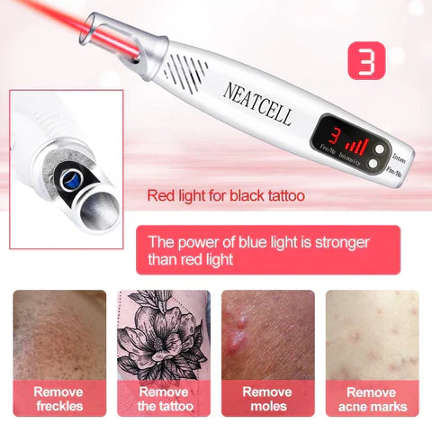 LumiDerm Laser Pen for Tattoo, Moles &amp; Freckles Removal