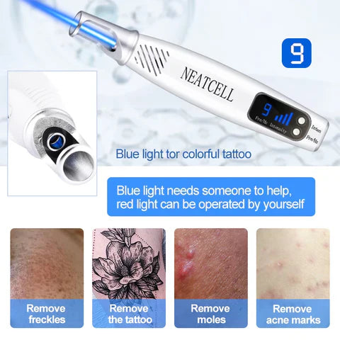 LumiDerm Laser Pen for Tattoo, Moles &amp; Freckles Removal