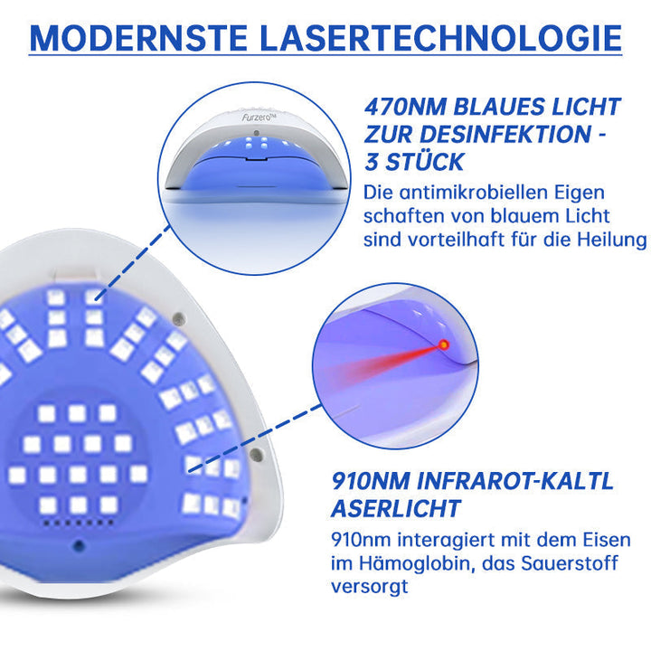 NailCure™ - Nail Fungus Laser Treatment Solution (50% DISCOUNT)