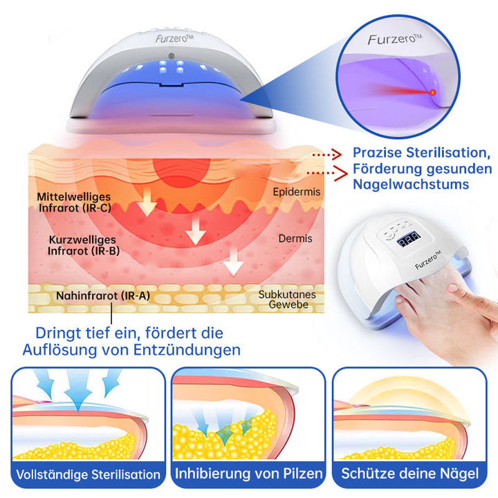 NailCure™ - Nail Fungus Laser Treatment Solution (50% DISCOUNT)