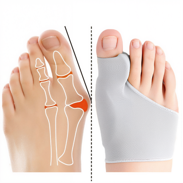 Niki | Bunion Corrector Gel Pad Toe Straightener for Foot Pain Relief