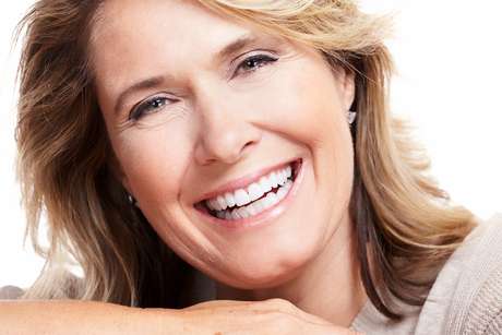 Niki | DentAlign Dental Veneers – Natural Fit and Comfort