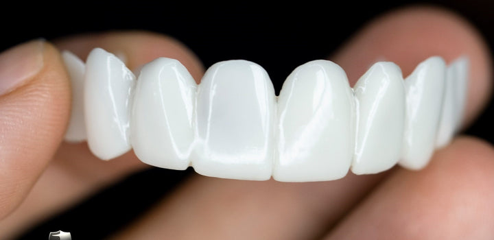 Niki | DentAlign Dental Veneers – Natural Fit and Comfort