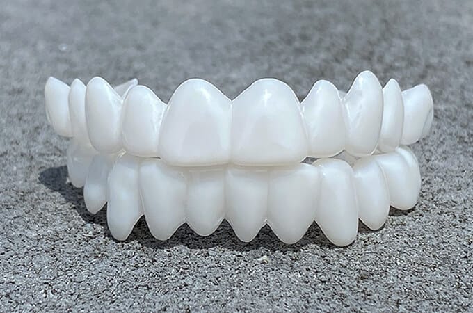 Niki | DentAlign Dental Veneers – Natural Fit and Comfort