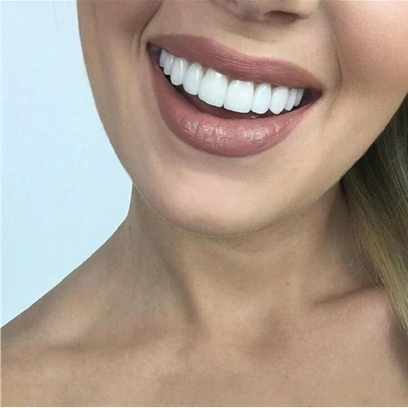 Niki | Instant Smile Cosmetic Veneers Dental Prothesis