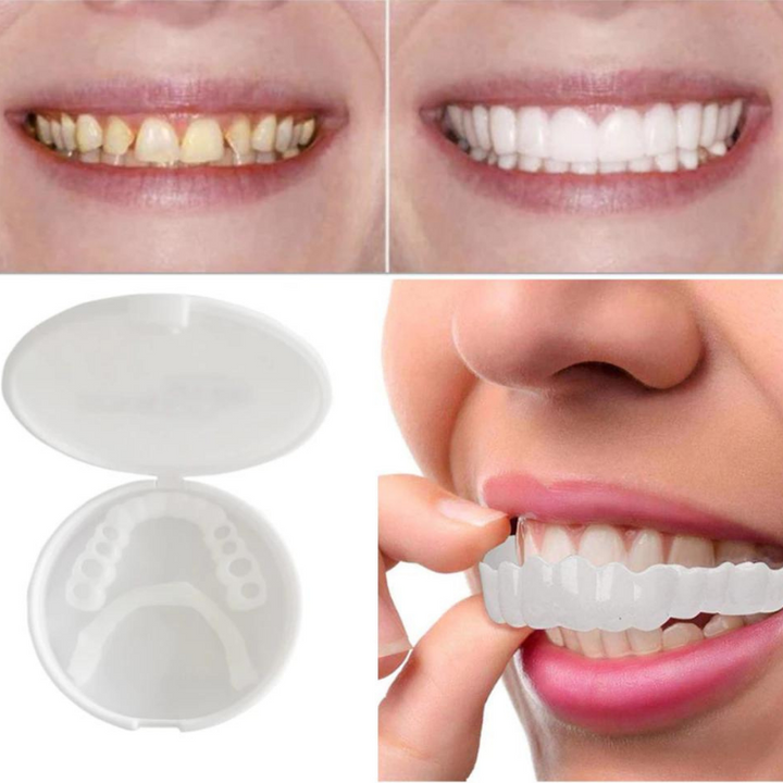 Niki | Instant Smile Cosmetic Veneers Dental Prothesis