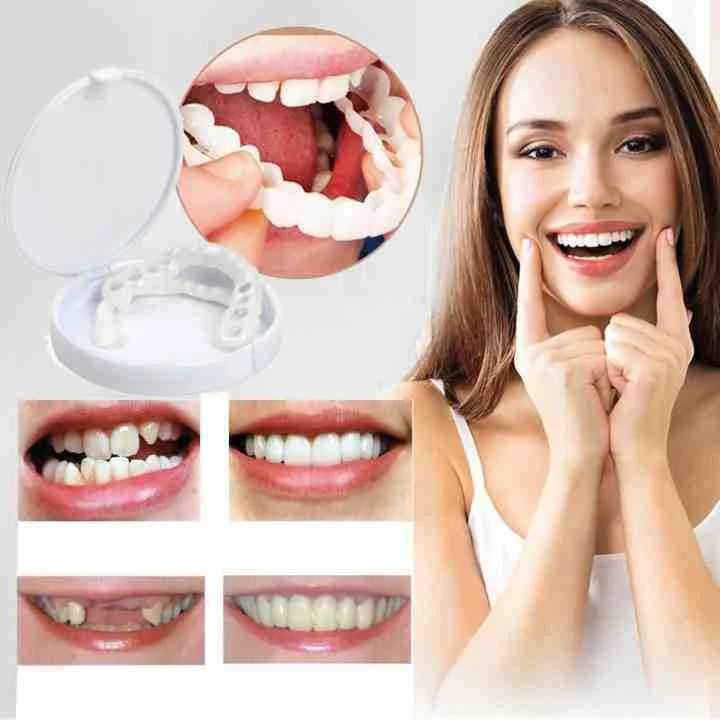 Niki | Instant Smile Cosmetic Veneers Dental Prothesis