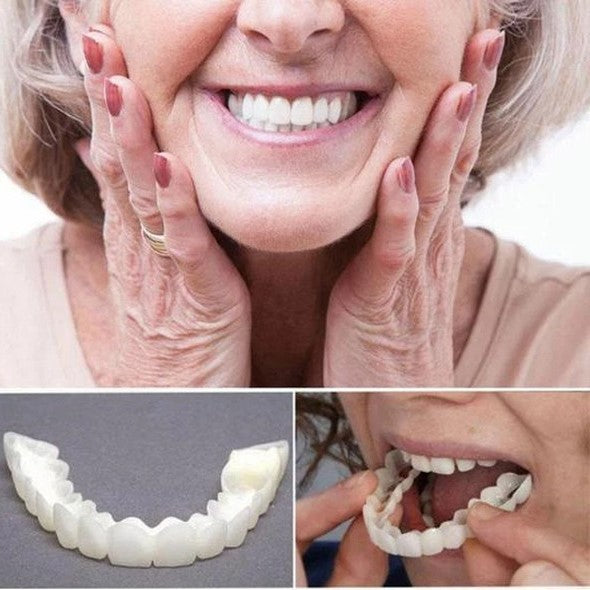 Niki | On Smile Veneers (Upper and Lower Jaw included)