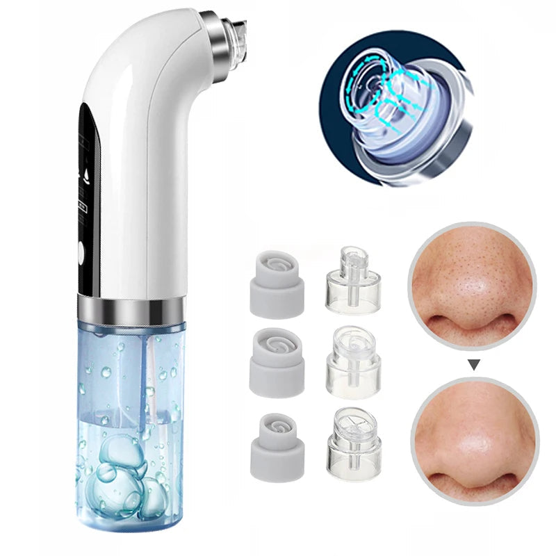 Niki | Professional Nose Blackhead Remover Vacuum - Deep Cleansing with Suction Technology