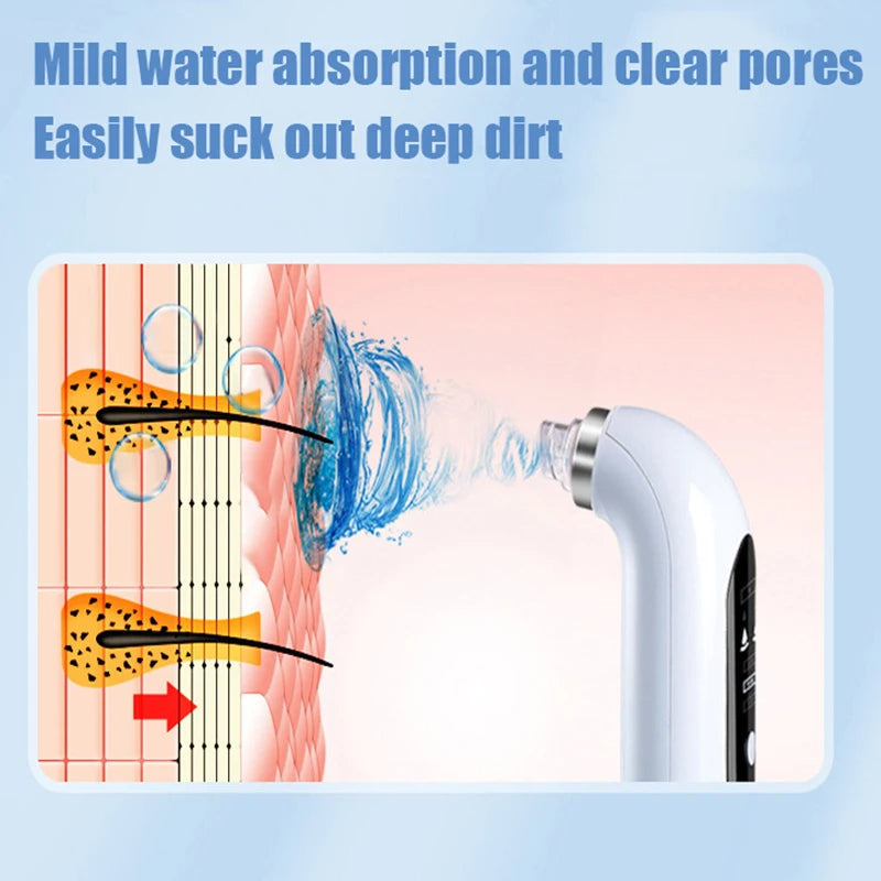Niki | Professional Nose Blackhead Remover Vacuum - Deep Cleansing with Suction Technology