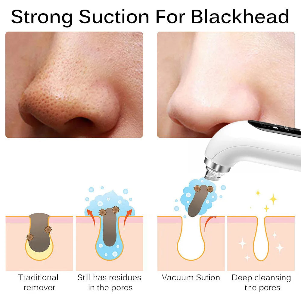 Niki | Professional Nose Blackhead Remover Vacuum - Deep Cleansing with Suction Technology