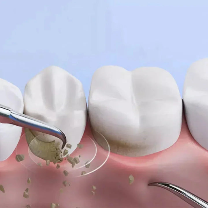 Niki | Ultrasonic Dental Scaler for Plaque &amp; Tartar Removal