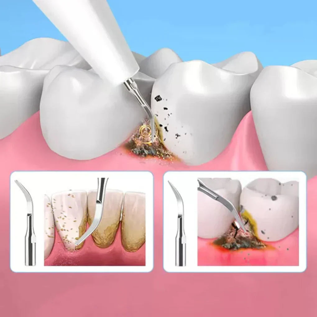 Niki | Ultrasonic Dental Scaler for Plaque &amp; Tartar Removal