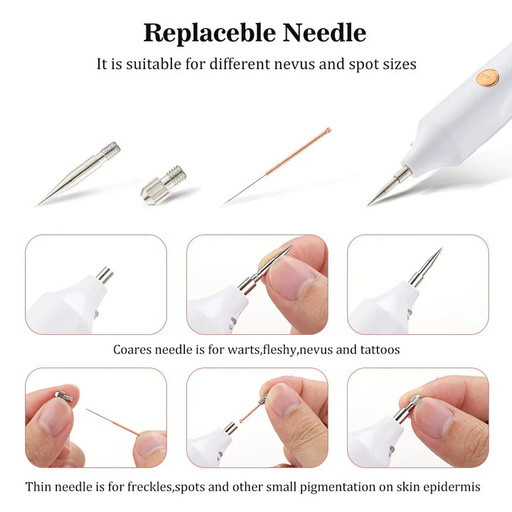 Plasma Pen Skin Tag Remover