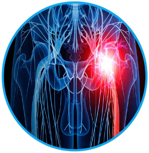 Sciatica Pain Relief Belt - eliminate your sciatica &amp; lower back pain